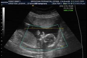 Baby Boy #2 - 15 weeks - body