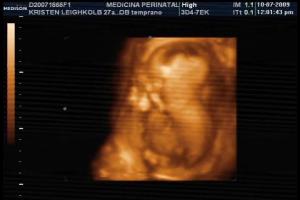 Baby Boy #2 - 15 weeks - face