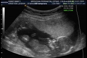 Baby Boy #2 - 15 weeks - Hand in mouth