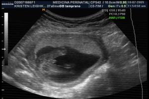 Baby Boy #2 - 15 weeks- Boy! 